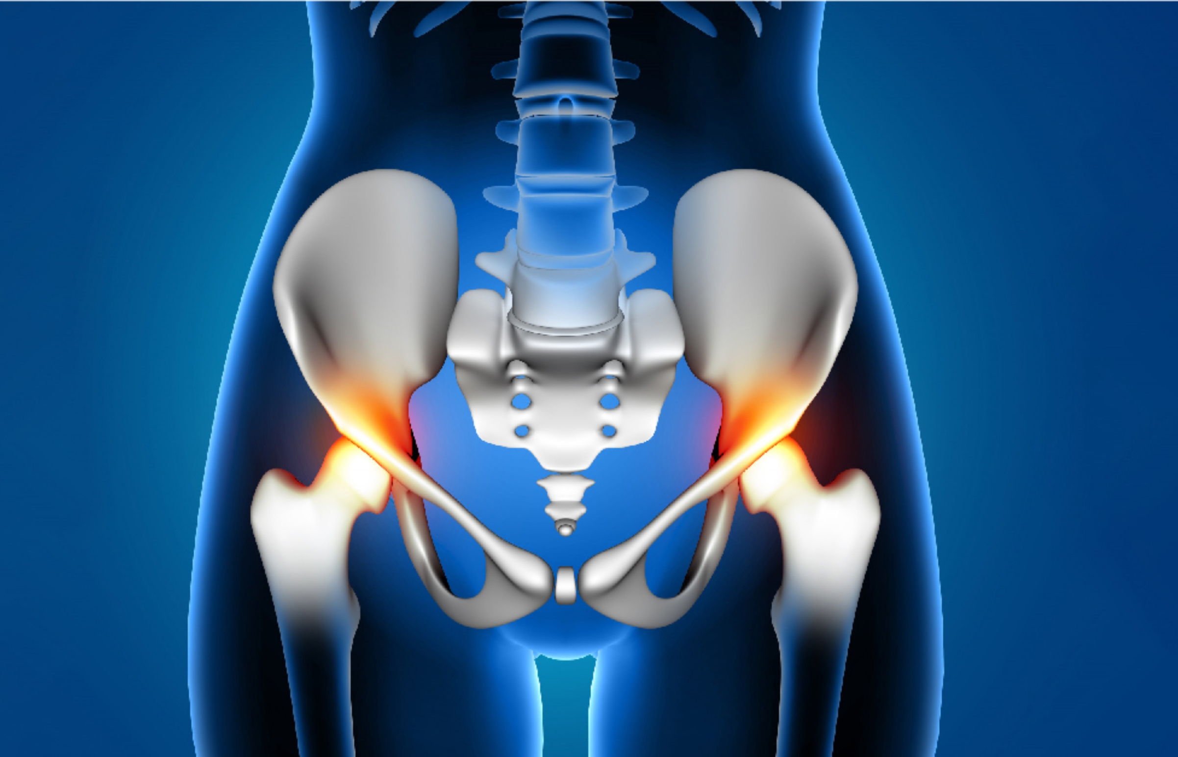 Hip Replacement