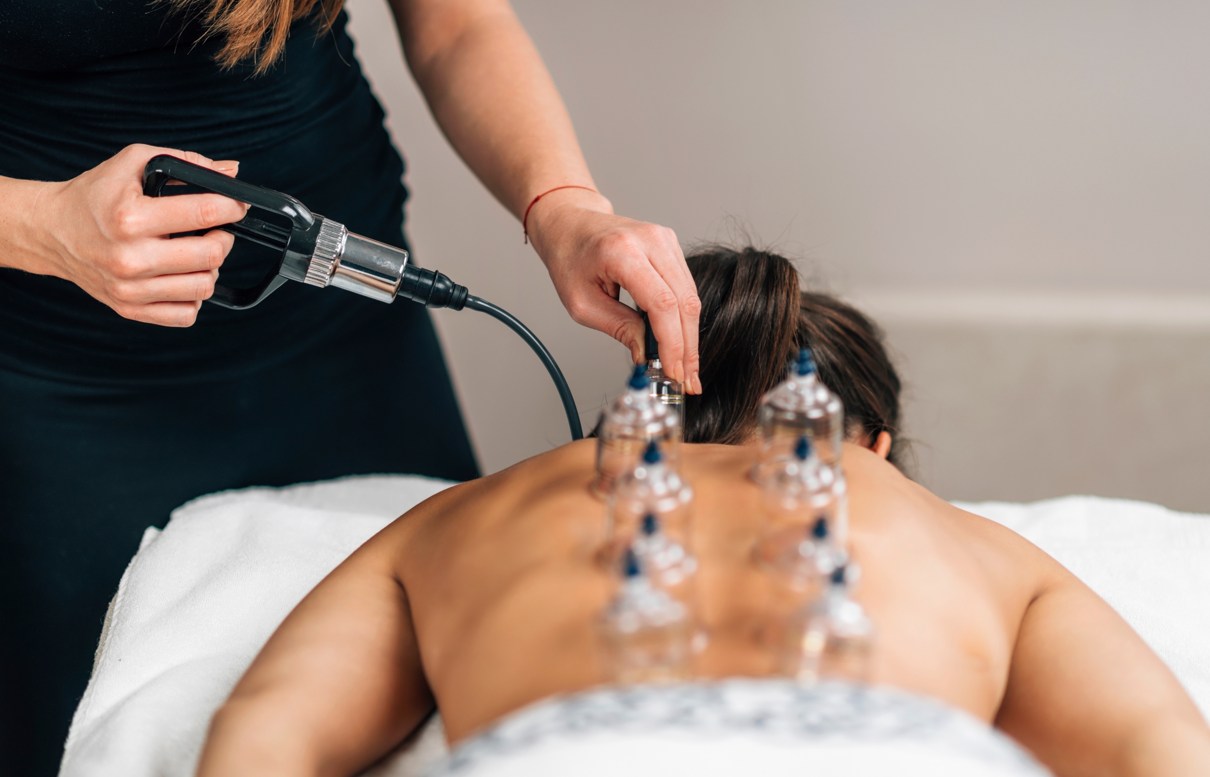 Cupping therapy